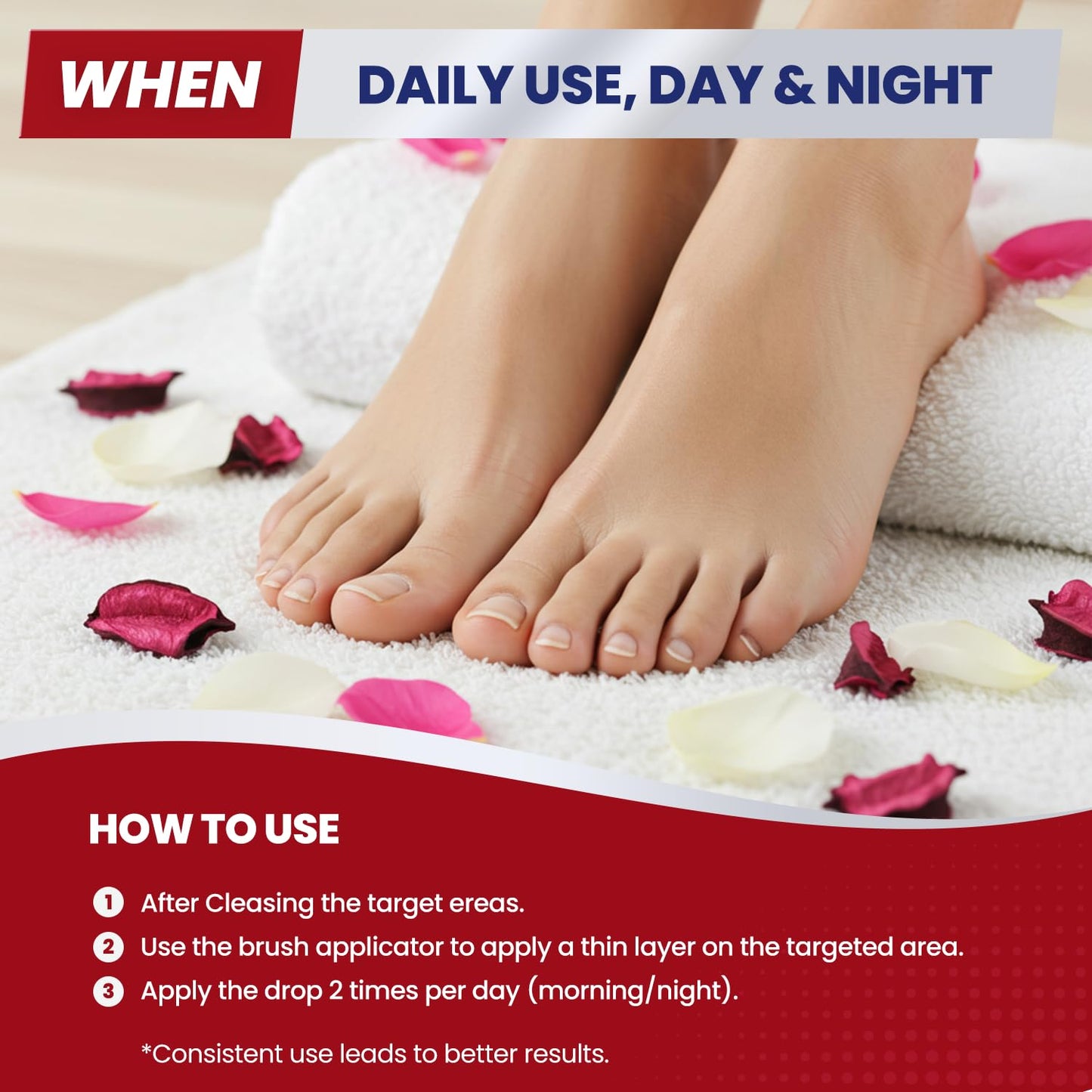 Treatonic Toenail Fungus Treatment Extra Strength: Antifungal Repair Solution with 25% Undecylenic Acid