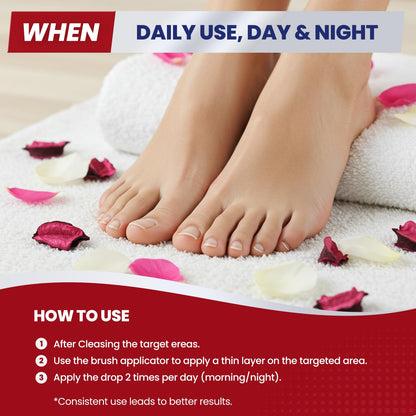 Treatonic Toenail Fungus Treatment Extra Strength: Antifungal Repair Solution with 25% Undecylenic Acid