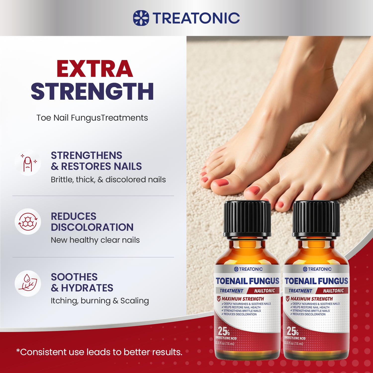 Treatonic Toenail Fungus Treatment Extra Strength: Antifungal Repair Solution with 25% Undecylenic Acid