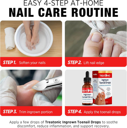 Nail Clippers for Thick & Ingrown Toenails