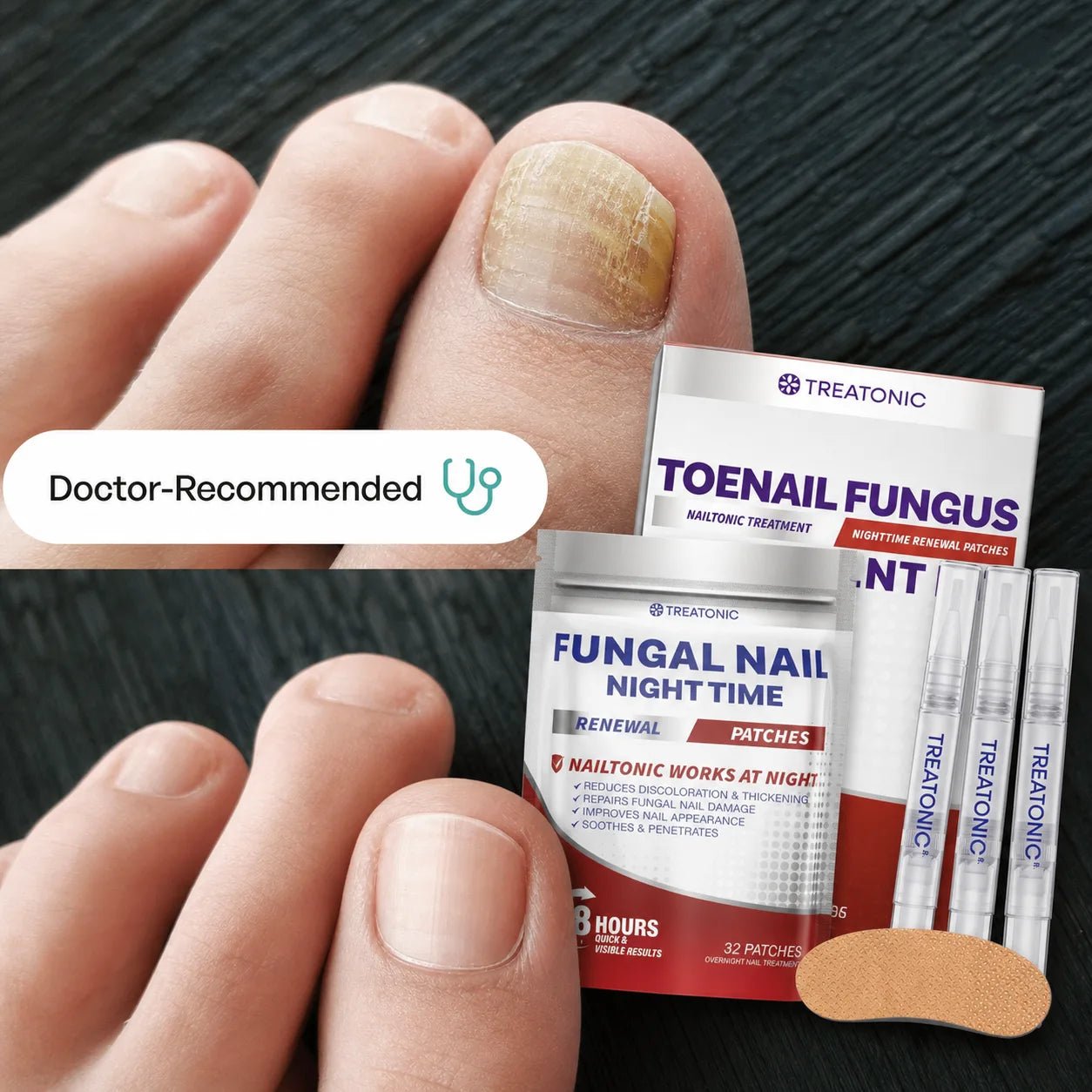 24/7 Day & Night Treatment Kit